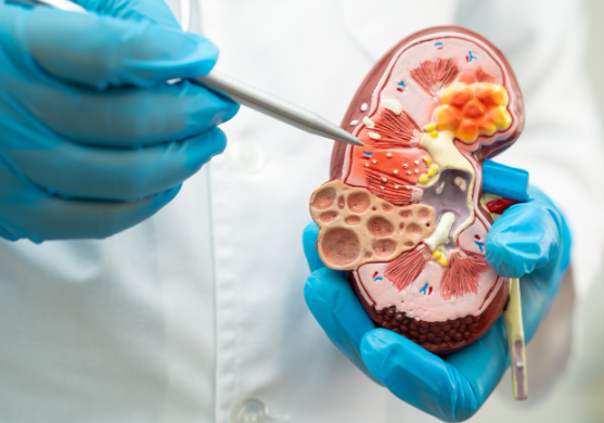 Nephrology
